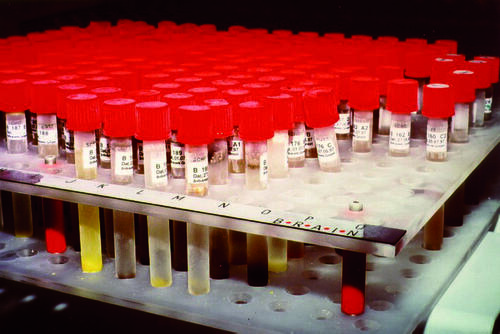 Biokatalytische Herstellung wertvoller Zwischen­produkte 