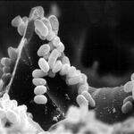 Bakterium Corynebacterium glutamicum 