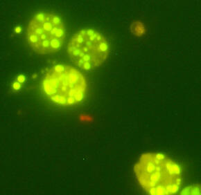Squalen-überproduzierende Hefezellen 