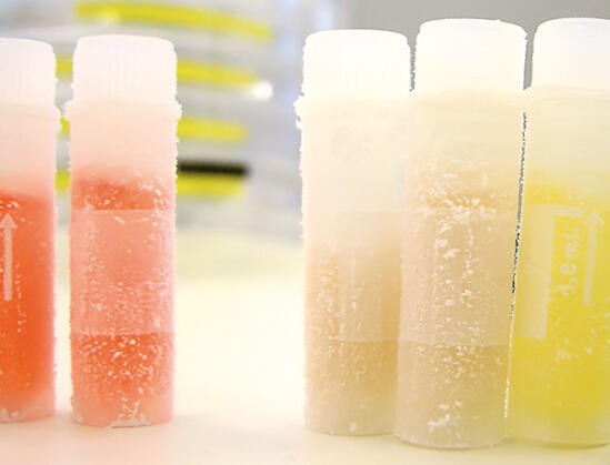 CAP-Zellen im Reagenzglas © CEVEC Pharmaceuticals