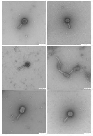 Phagen, elektronenmikroskopische Aufnahme © DBU-Projektpartner
