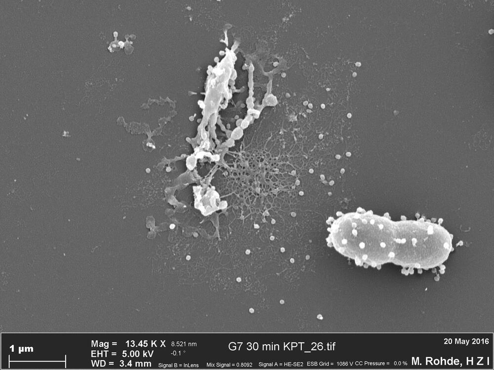 Phagenlyse EM-Aufnahme © DBU-Projektpartner