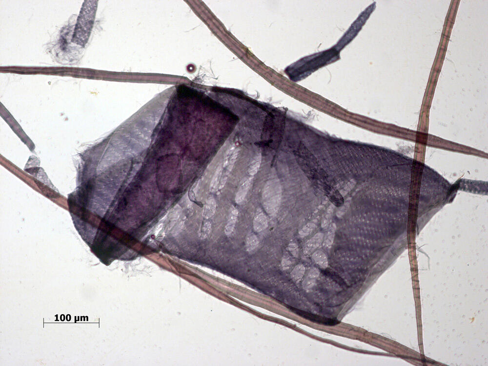 Mikroskopaufnahme einer Zelle 