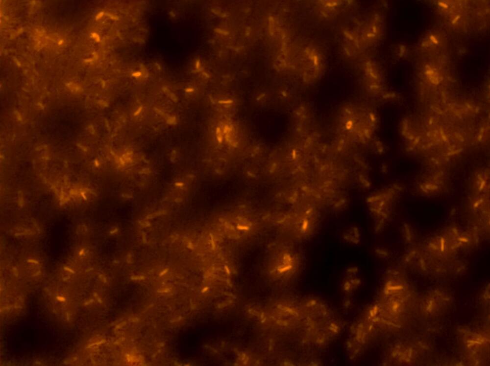 Milchsäurebakterien - Kopie 